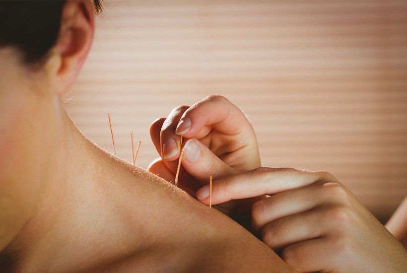 Akupunktur'un Tedavi Edici Etkisi Nedir?